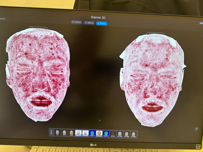 美容针在线观看仔仔网_美容针在线观看仔仔网_美容针在线观看仔仔网